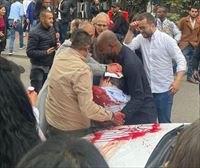 El precandidato opositor a presidente de Colombia Miguel Uribe, herido grave en un atentado