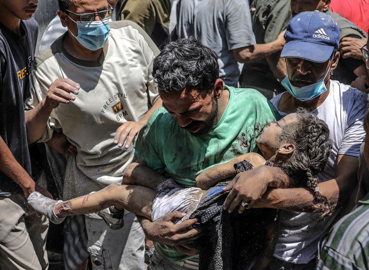 Una niña, víctima de un bombardeo israelí en Gaza. Foto: EFE