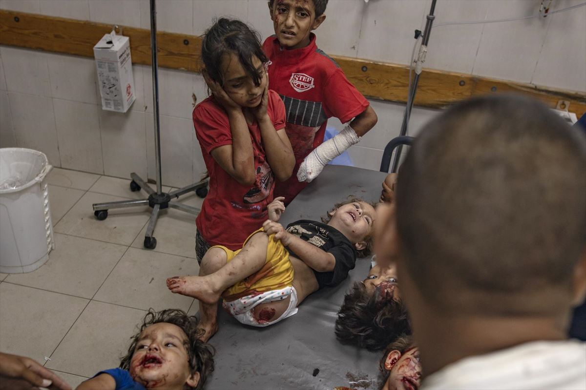 Niños heridos en un bombardeo israelí. EFE.