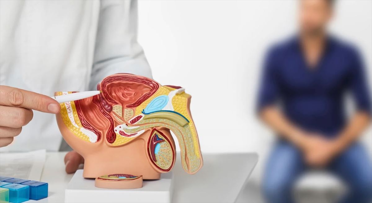 Cáncer de próstata