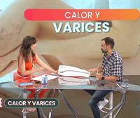 Iñaki Prieto: ''Las varices son una enfermedad, no un problema estético''