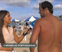 ¡Esto se siente cuando te pica una carabela portuguesa!